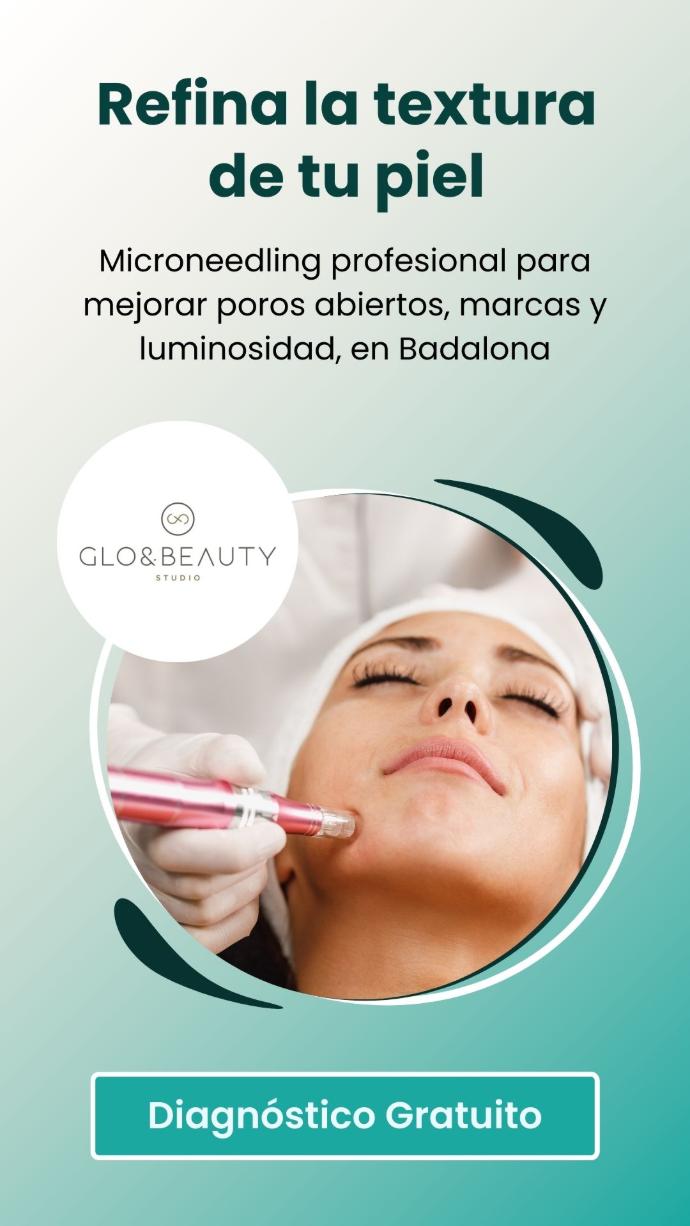 Microneedling profesional para poros abiertos y textura irregular en Studio Glo&Beauty Badalona