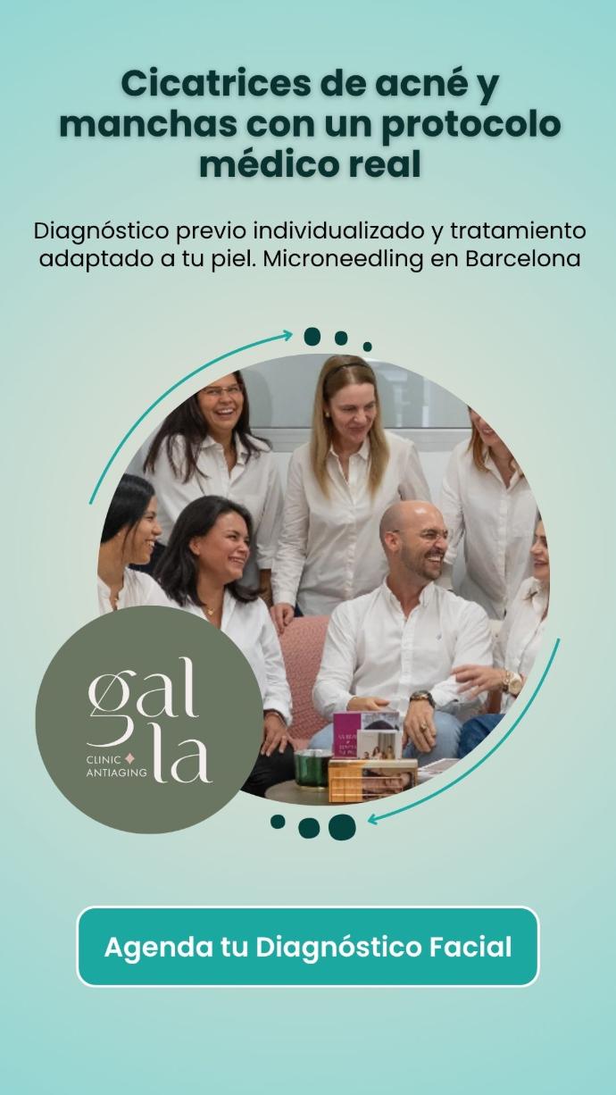 Microneedling médico para cicatrices de acné y manchas en Gal.la Clinic Barcelona