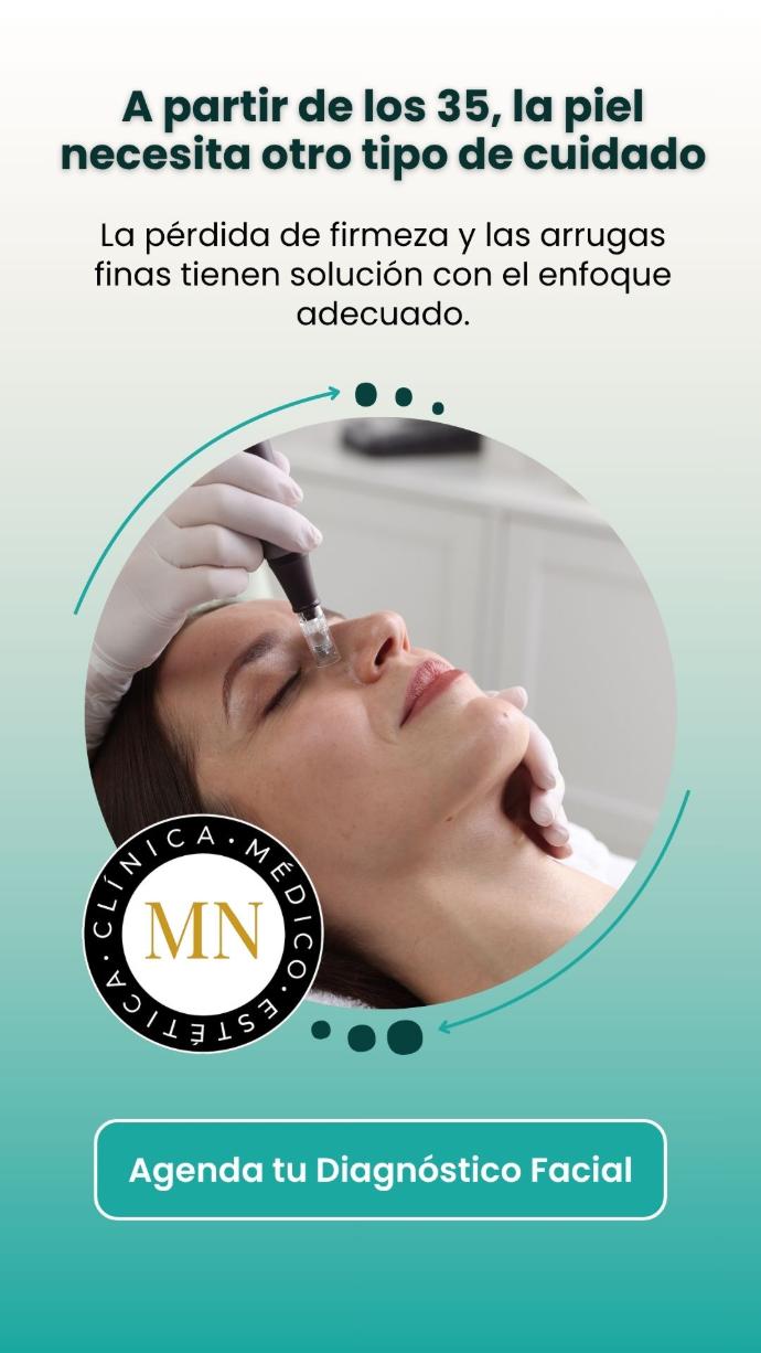 Microneedling en Alicante · Clínica Mayka Navarro